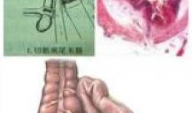 阑尾疼可以吃瓜吗,西瓜，甜蜜的禁忌？