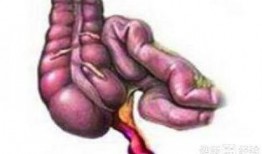 阑尾疼可以吃瓜吗,西瓜，甜蜜的禁忌？