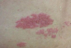 阑尾疼可以吃瓜吗,西瓜，甜蜜的禁忌？